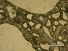 Link to full size image of micrograph 176