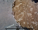 Link to full size image of micrograph 899