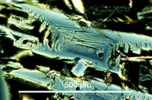 Link to full size image of micrograph 907
