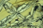Link to full size image of micrograph 927