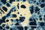 Link to full size image of micrograph 932