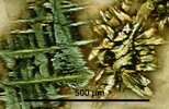 Link to full size image of micrograph 933