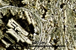 Link to full size image of micrograph 951