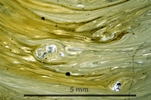 Link to full size image of micrograph 963
