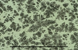 Link to full size image of micrograph 971
