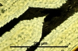 Link to full size image of micrograph 972