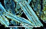 Link to full size image of micrograph 973