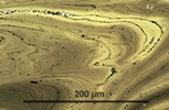 Link to full size image of micrograph 974